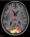 Photo Credit: Ai Koizumi, Scan of brain showing information associated with a fear memory 